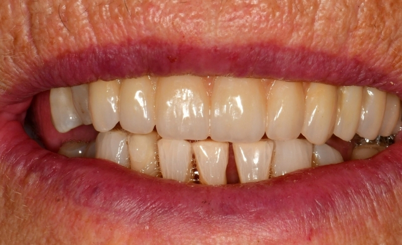 After -Bromsgrove Dental