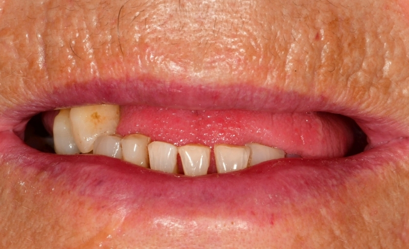 Before - Bromsgrove Dental