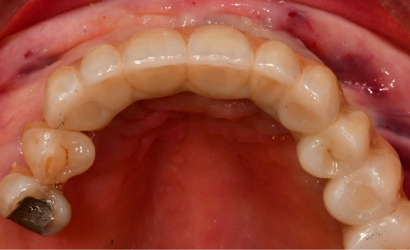 After -Bromsgrove Dental