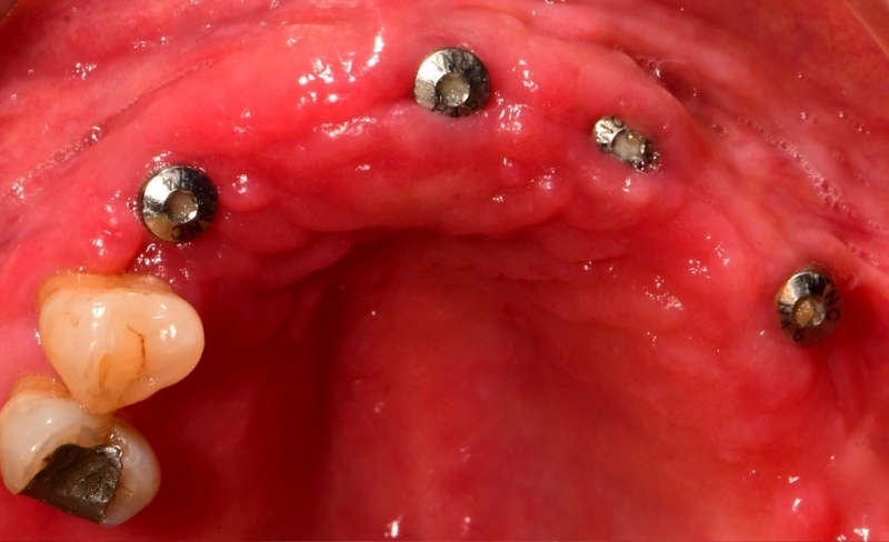 Before - Bromsgrove Dental