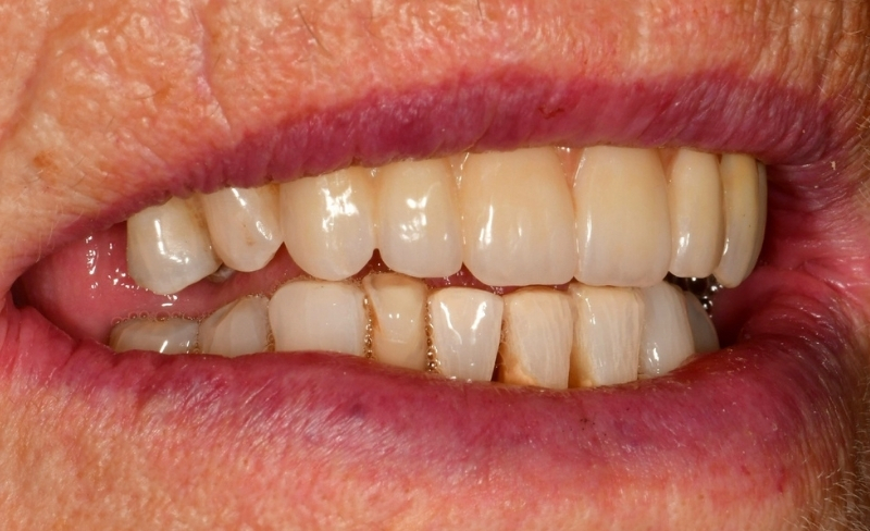 After -Bromsgrove Dental