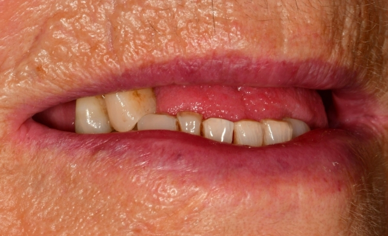 Before - Bromsgrove Dental