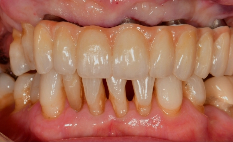 After -Bromsgrove Dental
