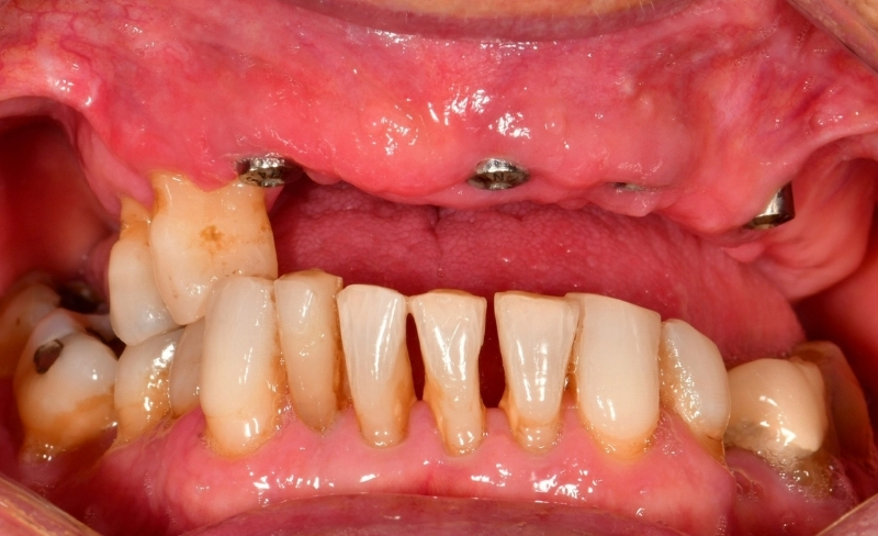 Before - Bromsgrove Dental