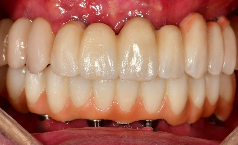 After -Bromsgrove Dental