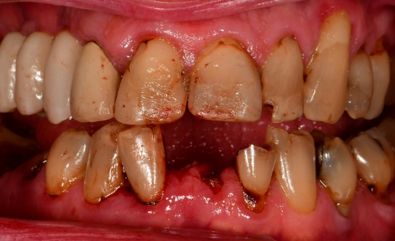 Before - Bromsgrove Dental