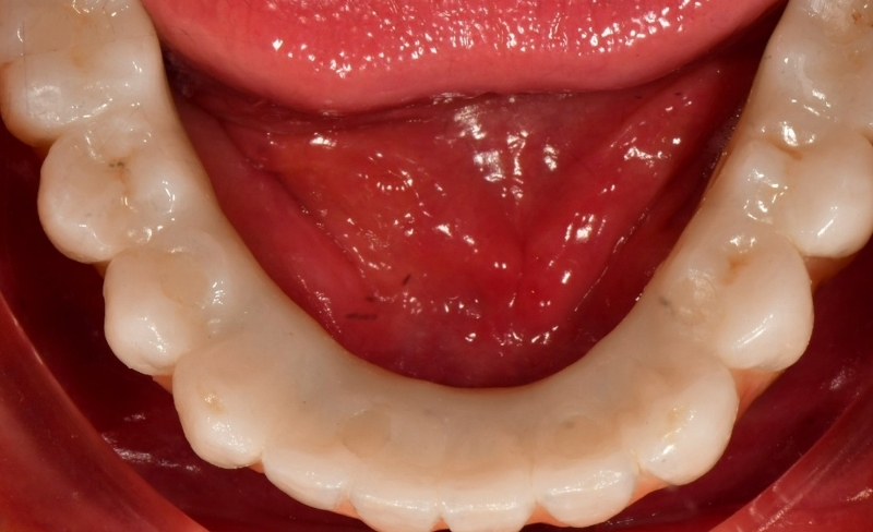 After -Bromsgrove Dental