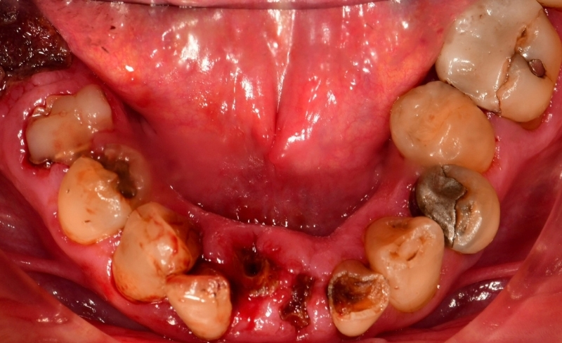 Before - Bromsgrove Dental