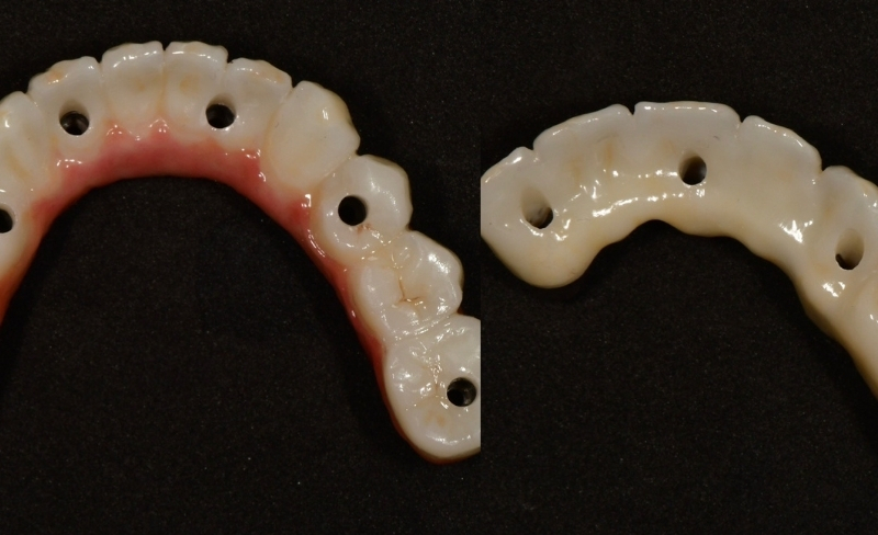 After -Bromsgrove Dental