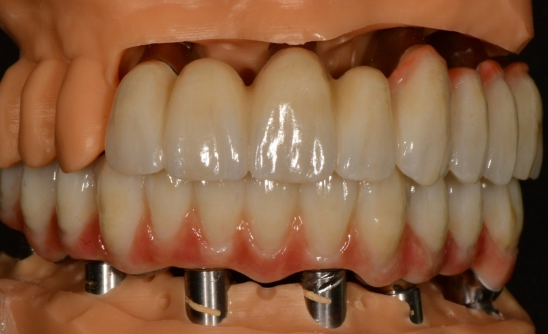 Before - Bromsgrove Dental