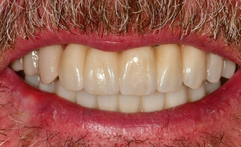 After -Bromsgrove Dental