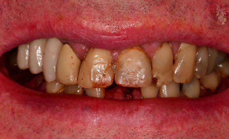 Before - Bromsgrove Dental