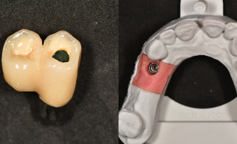 After -Bromsgrove Dental