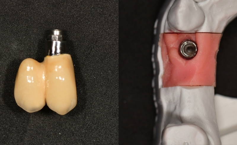 Before - Bromsgrove Dental