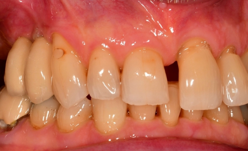 After -Bromsgrove Dental