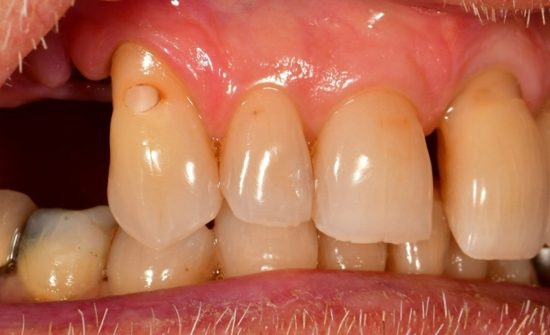 Before - Bromsgrove Dental