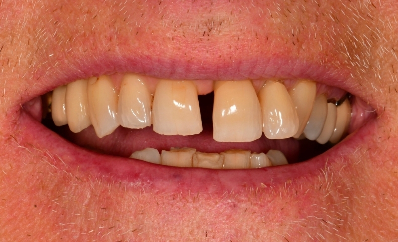 After -Bromsgrove Dental