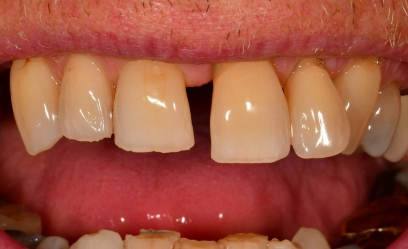 Before - Bromsgrove Dental