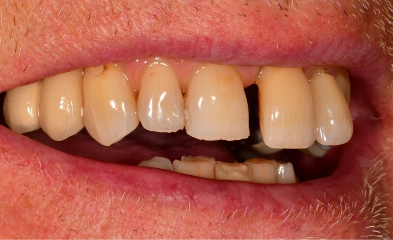 After -Bromsgrove Dental