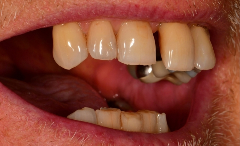 Before - Bromsgrove Dental