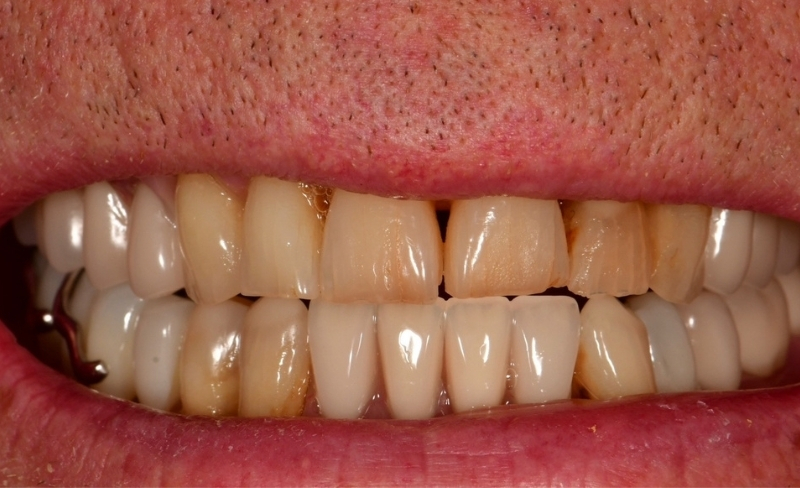 After -Bromsgrove Dental