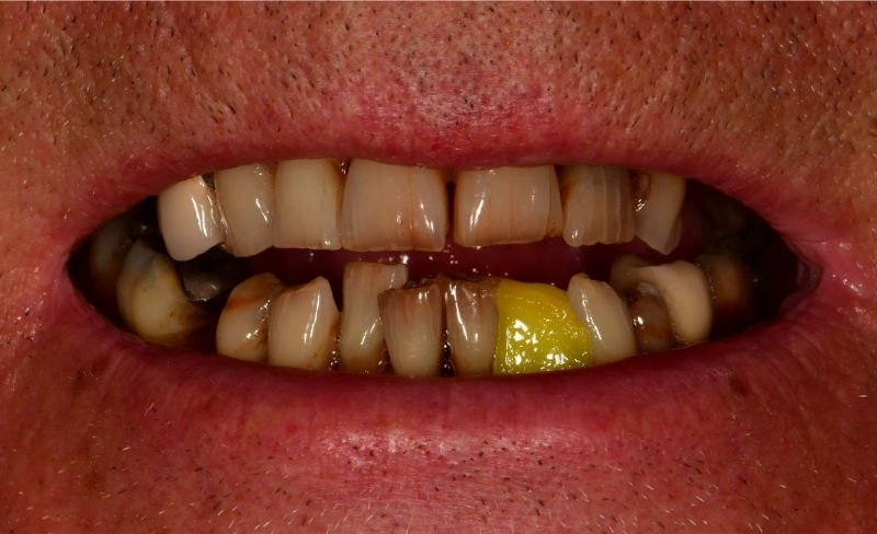 Before - Bromsgrove Dental