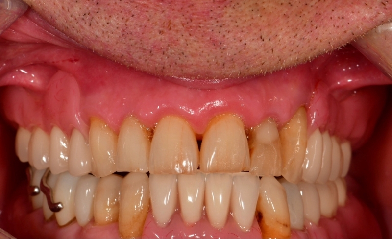 After -Bromsgrove Dental