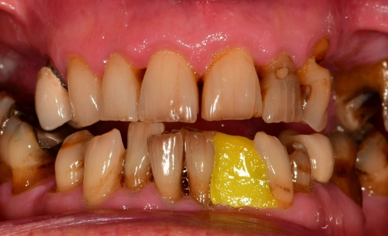 Before - Bromsgrove Dental