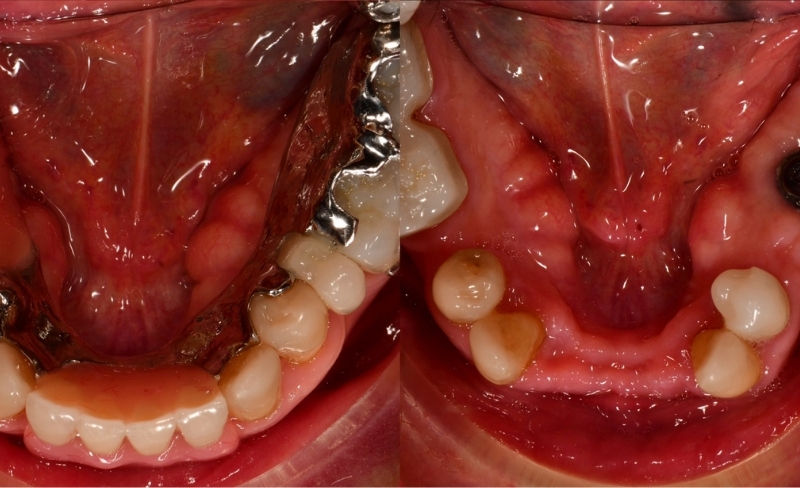 After -Bromsgrove Dental