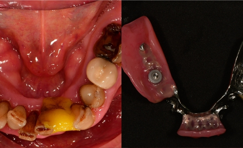 Before - Bromsgrove Dental