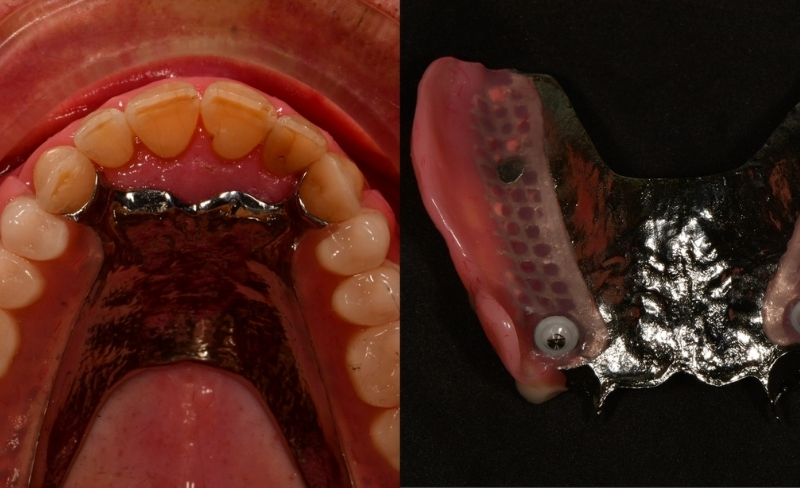 After -Bromsgrove Dental