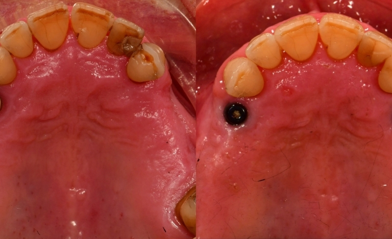 Before - Bromsgrove Dental