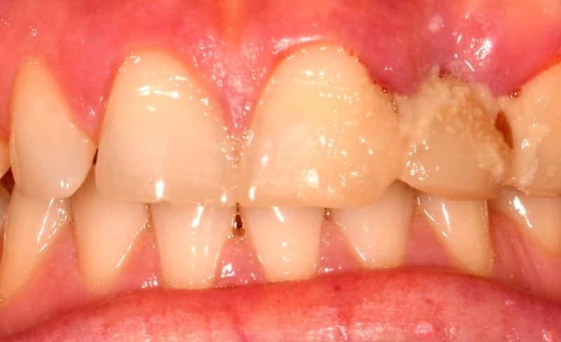 After -Bromsgrove Dental