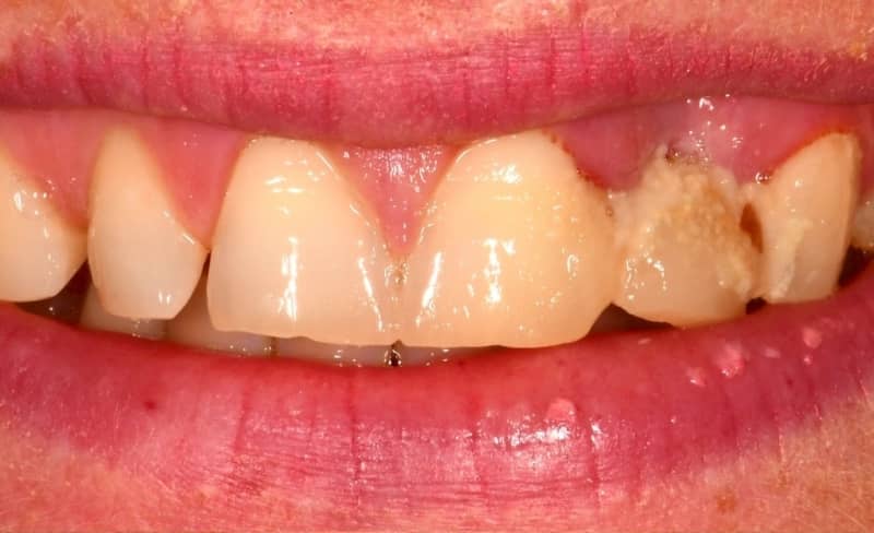 Before - Bromsgrove Dental