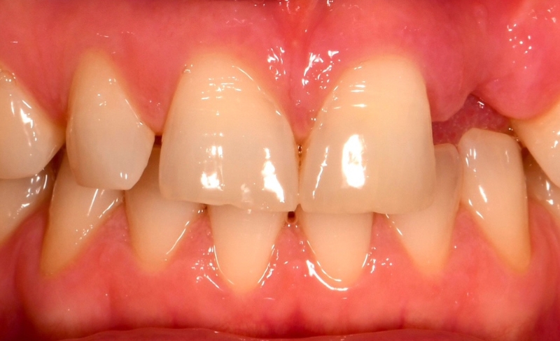 After -Bromsgrove Dental