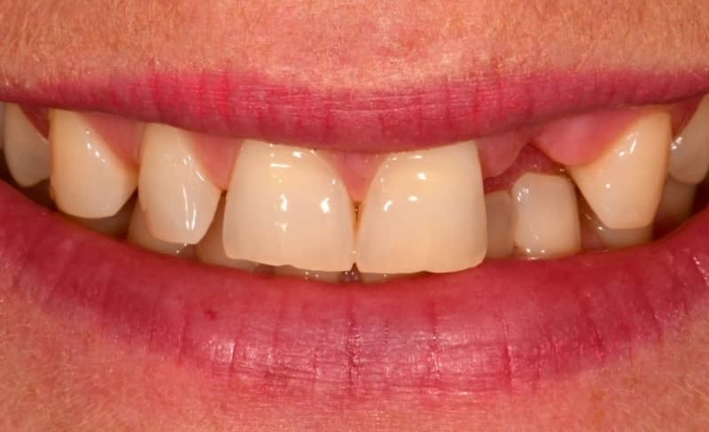 Before - Bromsgrove Dental