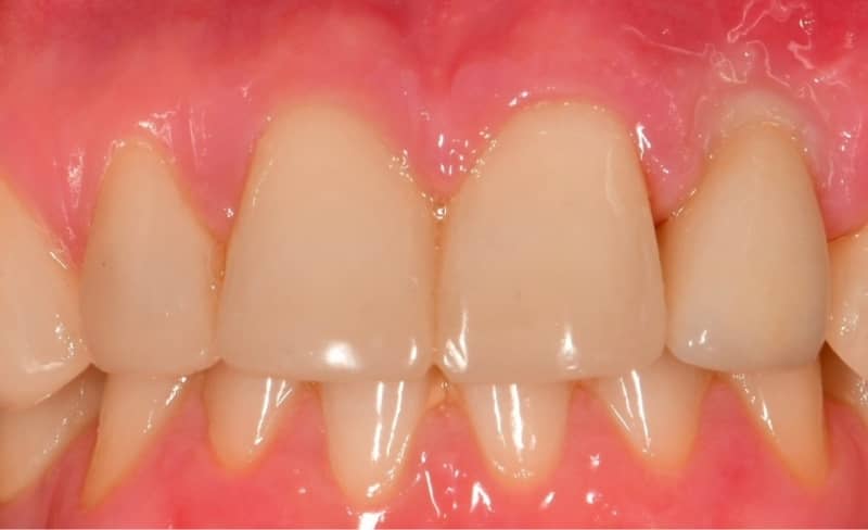 After -Bromsgrove Dental