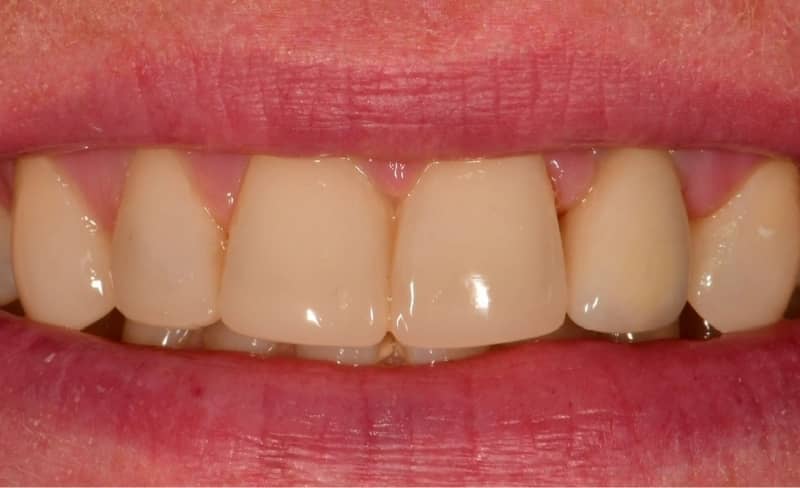 Before - Bromsgrove Dental