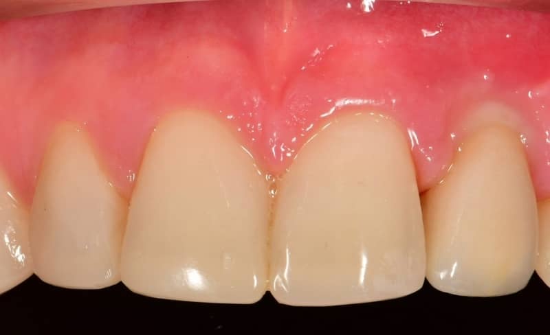 After -Bromsgrove Dental