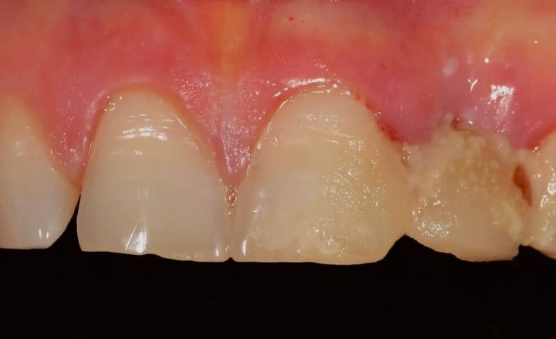 Before - Bromsgrove Dental