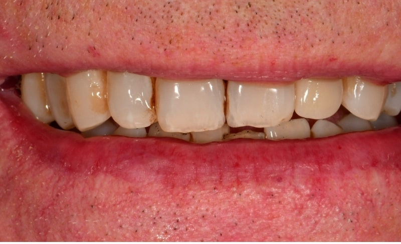 After -Bromsgrove Dental