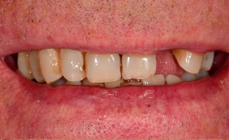 Before - Bromsgrove Dental