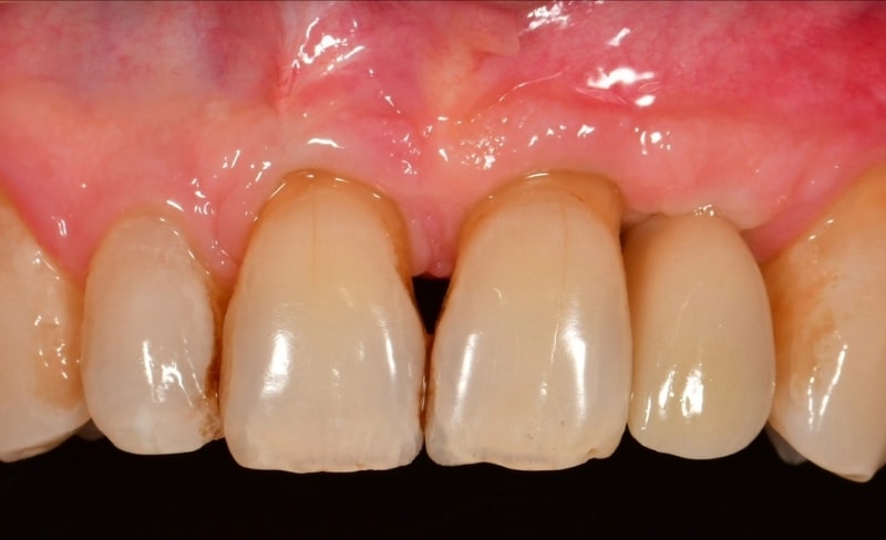 After -Bromsgrove Dental