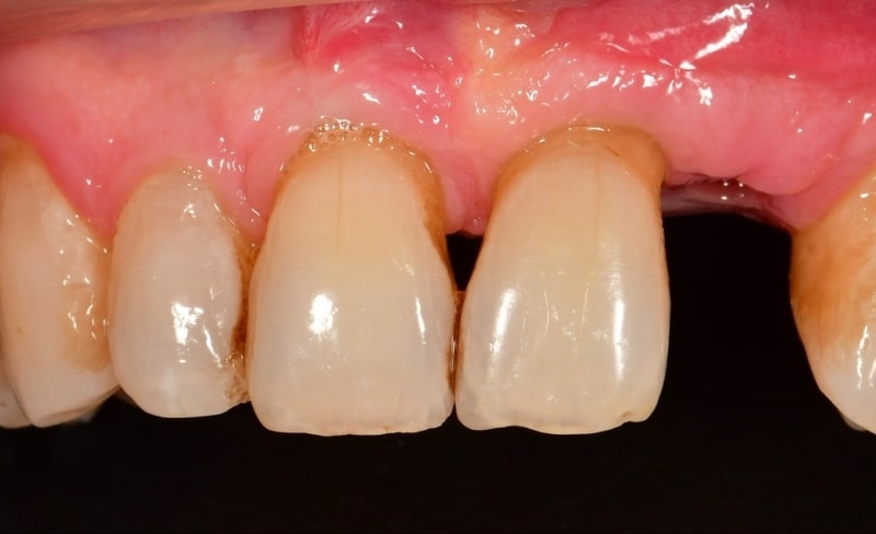 Before - Bromsgrove Dental