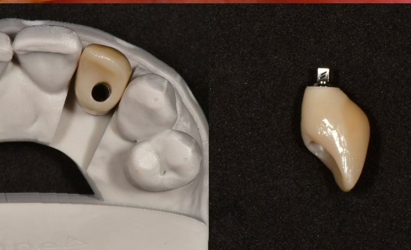 After -Bromsgrove Dental