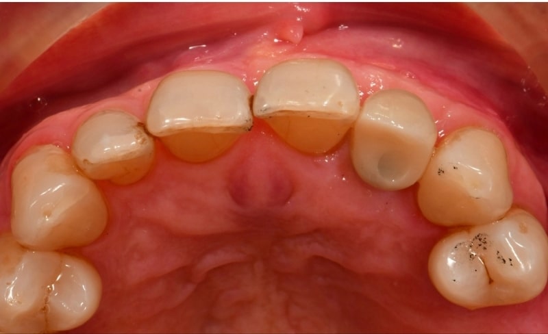 Before - Bromsgrove Dental
