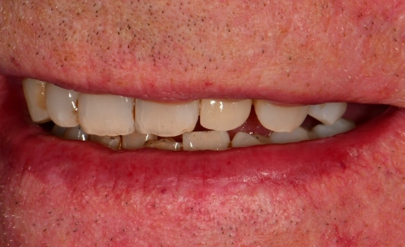 After -Bromsgrove Dental