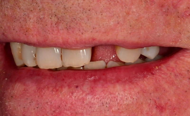 Before - Bromsgrove Dental