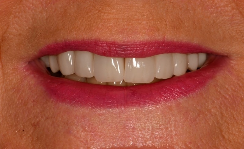 After -Bromsgrove Dental