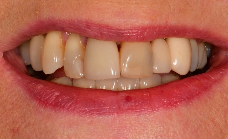 Before - Bromsgrove Dental